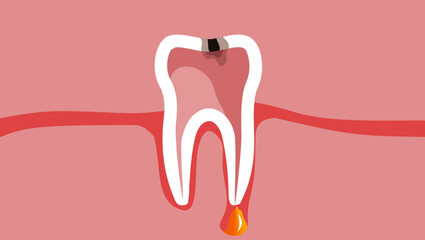 periodontitis emblem, flat color illustration
