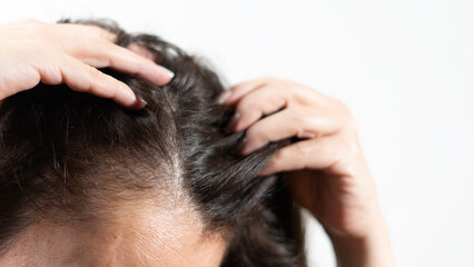 woman have hair loss problem