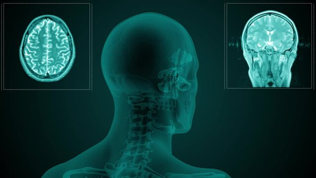 Magnetic resonance scan of the head of a man with visible paranasal sinuses. Anatomically correct 3d animation on dark background