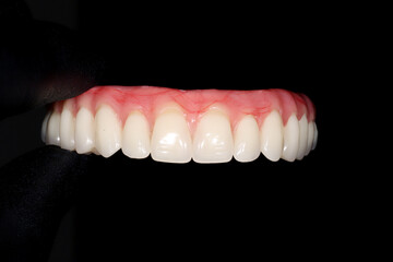 Obraz premium digital laboratory dentist prosthesis