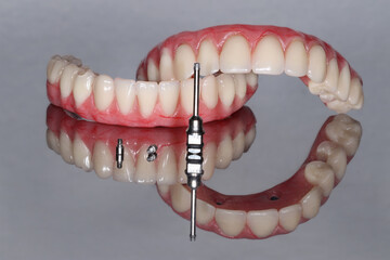 digital laboratory dentist prosthesis
