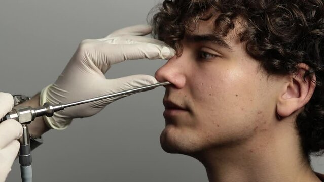 4k video Nose endoscopy. Rhinoscopy procedure with rhinoscope. ENT doctor otolaryngologist with headlight treat nose man patient.
