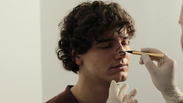 4k video process of drawing markup on male nose before rhinoplasty and septoplasty surgery. ENT doctor preparing patient for rhinoplasty surgery that changes the shape of the nose.