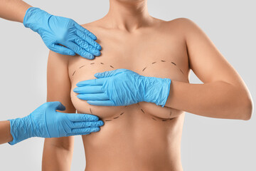 Naked young woman with marks on her breasts and plastic surgeon on light background, closeup