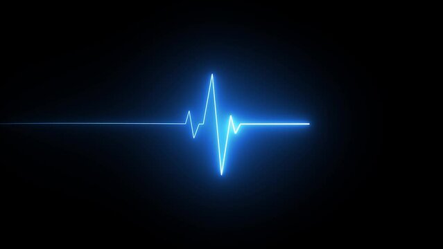 heart beat on monitor