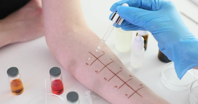 Skin prick test for allergies on the arm in clinic