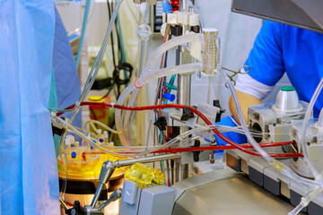 During doctor performing surgery used surgical equipment, anesthesia machine in operating room