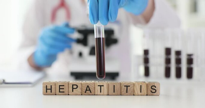 Doctor holds test tubes with blood and word hepatitis