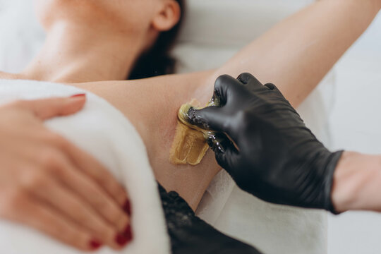 Sugaring: epilation with liquate sugar at armpit.