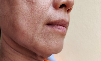 portrait the wrinkle and Flabby skin, Flabbiness and loose beside the mouth, dark spots and blemish, dullness and dry skin on the face of middle aged women, health care and beauty concept.