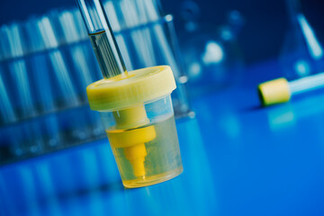 container with a sample of urine in the laboratory