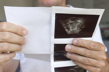 An unknown man holds ultrasound examination cards, highlighting the importance of preventive...