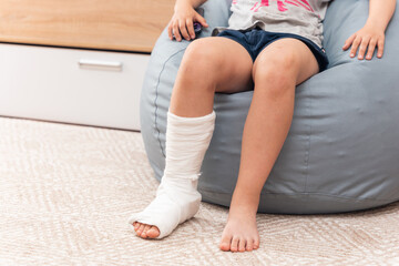 A child with a broken leg in a cast sits in a bean bag chair