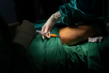 Female patient with marks on skin lying on medical bed while doctor preparing tools.Plastic surgeon sewing up breast of female patient after inserting implants in operating room.