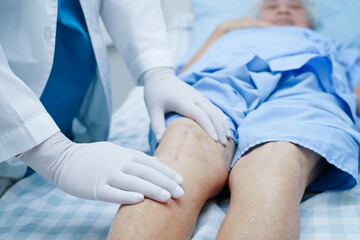 Doctor checking Asian elderly woman patient with scar knee replacement surgery in hospital.
