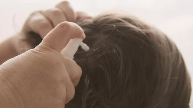 Close-up child's head, Mother's hands applying lice and nit treatment in hair, treating with medication, regular hygiene and pest control, Pediculosis