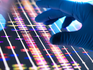 Genomic Research, Scientist examining DNA profiles after analytical testing in the lab.
