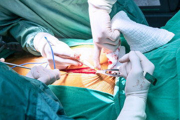 Close up group of surgeons in Surgery operating room. Medical team of surgeons doing surgery in...