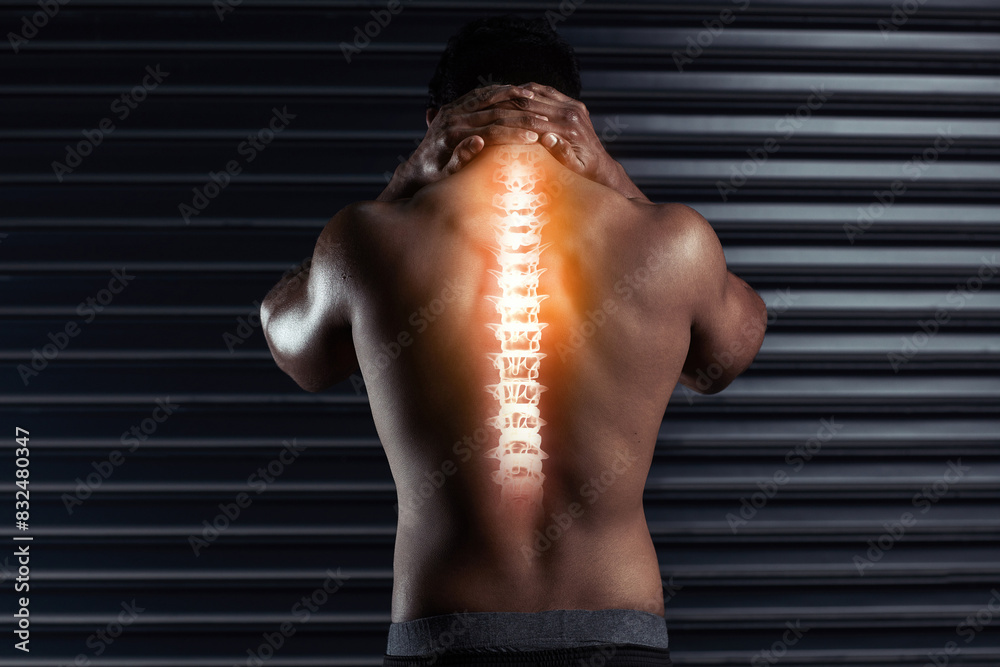 Sticker Back, xray and pain in spine with man by black background for injury, workout and accident in gym. Bodybuilder, athlete and wellness or anatomy for training, exercise and neck fracture in studio