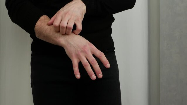Skin disease. Skin allergies, man itches, allergic redness of hands