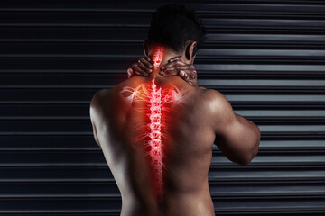 Back, xray and spine with pain and man by black background for injury and accident in gym....