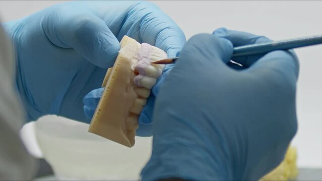 Dental Technician Colors Implant Prosthesis in Laboratory Footage.