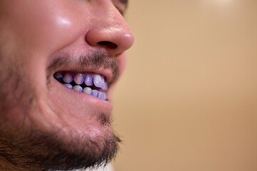 A man with blue teeth looks amused in a closeup shot, with a spontaneous and vibrant expression...