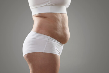 Woman with excessive belly fat on grey background, closeup. Overweight problem