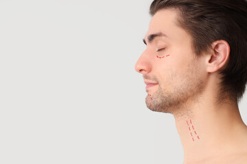 Obraz premium Young man with marked face on light background, closeup. Plastic surgery concept