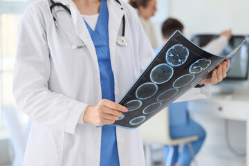 Young female doctor with MRI scan in clinic, closeup