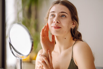 Portrait of a young woman without makeup with Acne skin. Concept of acne therapy, scars,...