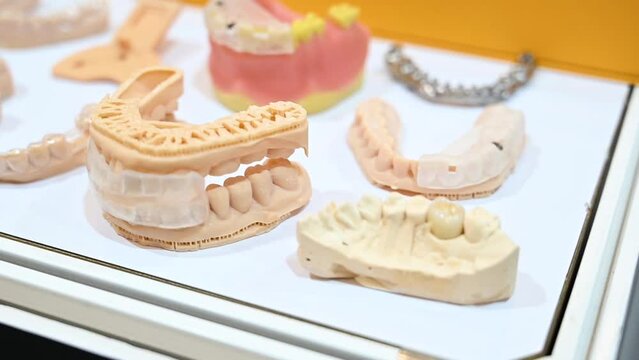 Dental prosthetics Set of Dentures on Exhibition 