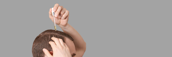 Obraz premium Man baldness treatment. Anti hairloss clinic mask. Nature hair care procedure. Oil drop at scalp. Male person applying dermatology lotion. Home routine. Trichologist cosmetic product. Banner