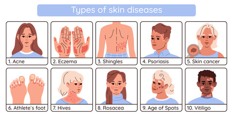 Infographics of types of skin diseases. Scheme of different dermatological skin diseases young and old people.