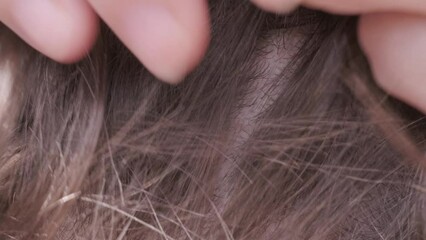 Parent's hands checking school-age child's hair for insects, searching for lice and nits, close-up head, importance of regular checks and preventive care