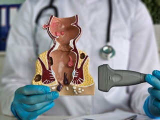 Treatment of diseases of rectum, hemorrhoids and constipation and ultrasound