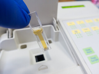 Optical measurement of the color of the test liquid in a cuvette using a spectrophotometer.