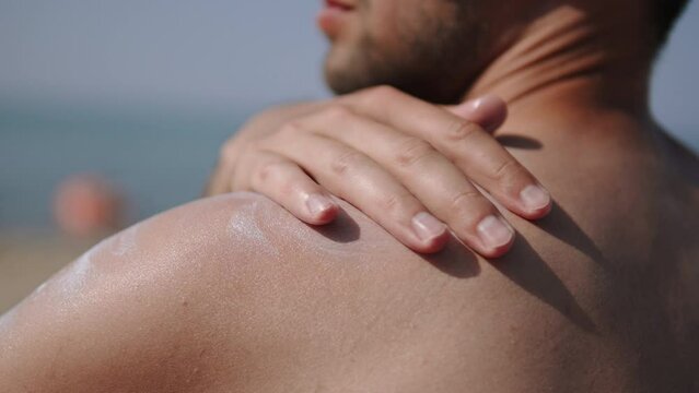 Close-up of sunscreen being applied to man bare shoulder. Man applies lotion with SPF protection for safe tan while on vacation on the seaside.