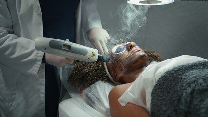 Laser pulsing patient face closeup. Cosmetician hands peeling exfoliating skin.