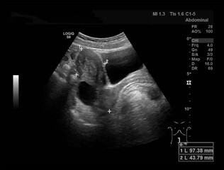 Abdominal Ultrasound Image with Detailed Organ Structures, Perfect for Medical Education and Diagnostic Research, Suitable for 4K Wallpaper, Wall Art
