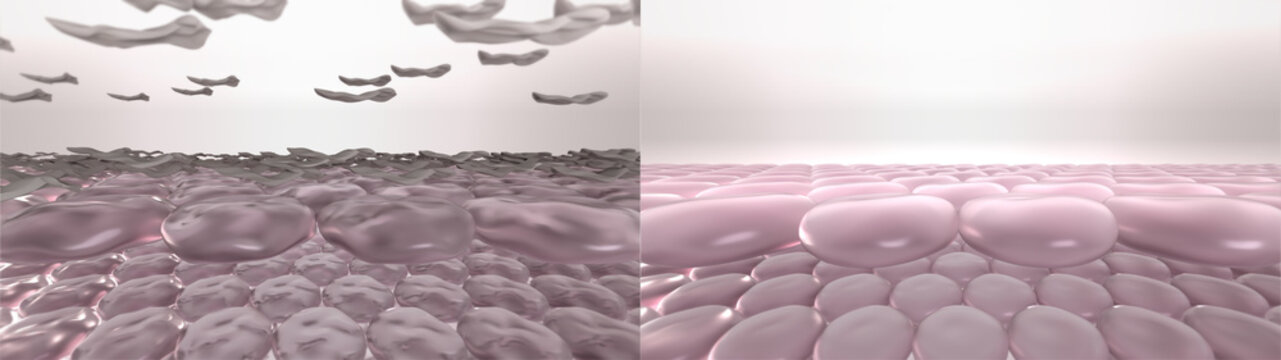 Skin dry dead cells exfoliation process. 3D render of stylized skin layers before and after chemical peeling, laser resurfacing, microdermabrasion, or action of skin exfoliating cosmetic products