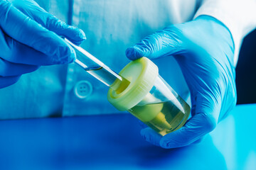 man in the lab filling a tube with a urine sample