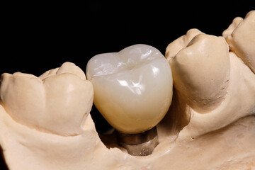  digital laboratory dentist prosthesis