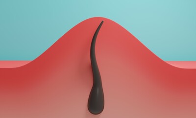 Ingrown hair with redness. 3d rendering