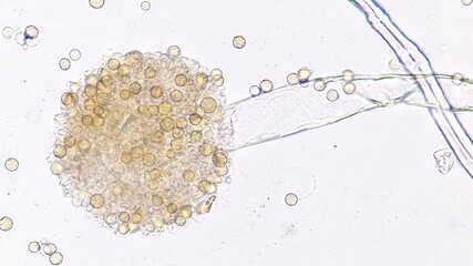 Mold species (Aspergillus sp) under microscope. Fresh sample whithout staining. Stacked image