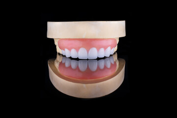 model teeth, 8 porcelain teeth in the upper jaw