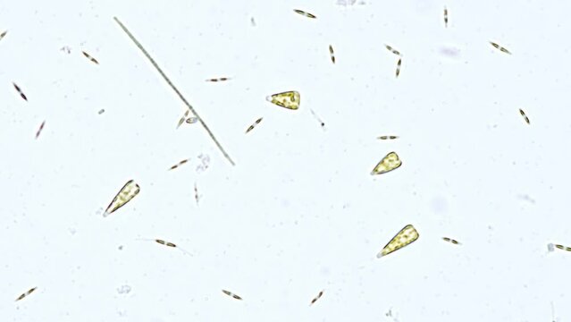 marine diatom algae under the microscope - optical microscope x400 magnification