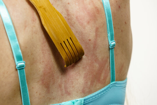 Woman scratching her itchy back using scratcher
