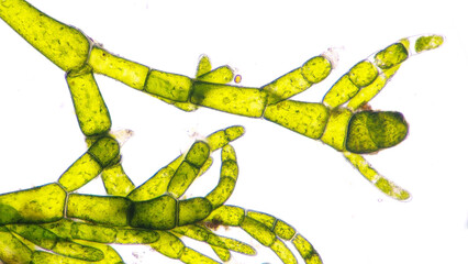 Marine green algae under microscope. The species is probably Cladophora sp. Stacked photo