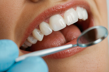 Close-up of female patient with open mouth during oral examination with mirror nearby at dentist